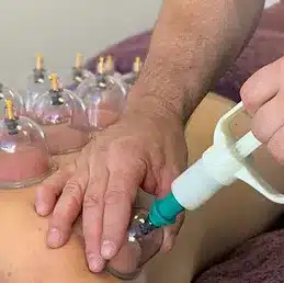 Ken doing cupping service